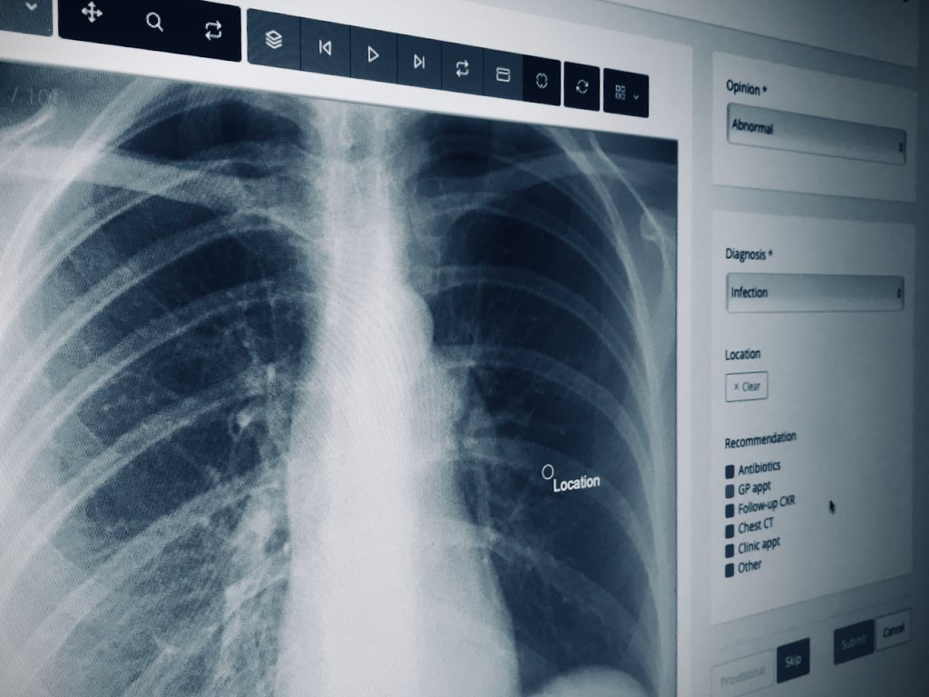cxr-display