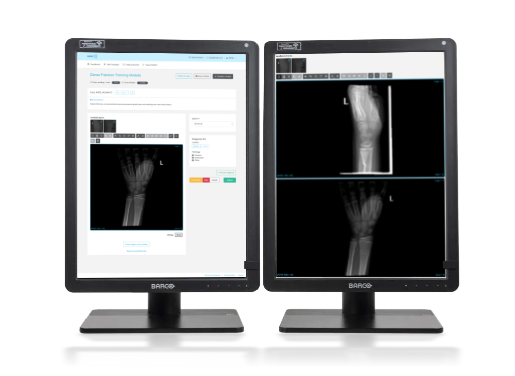 double displays fracture