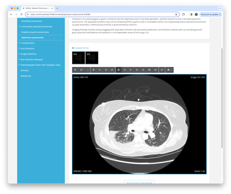 Interactive case
