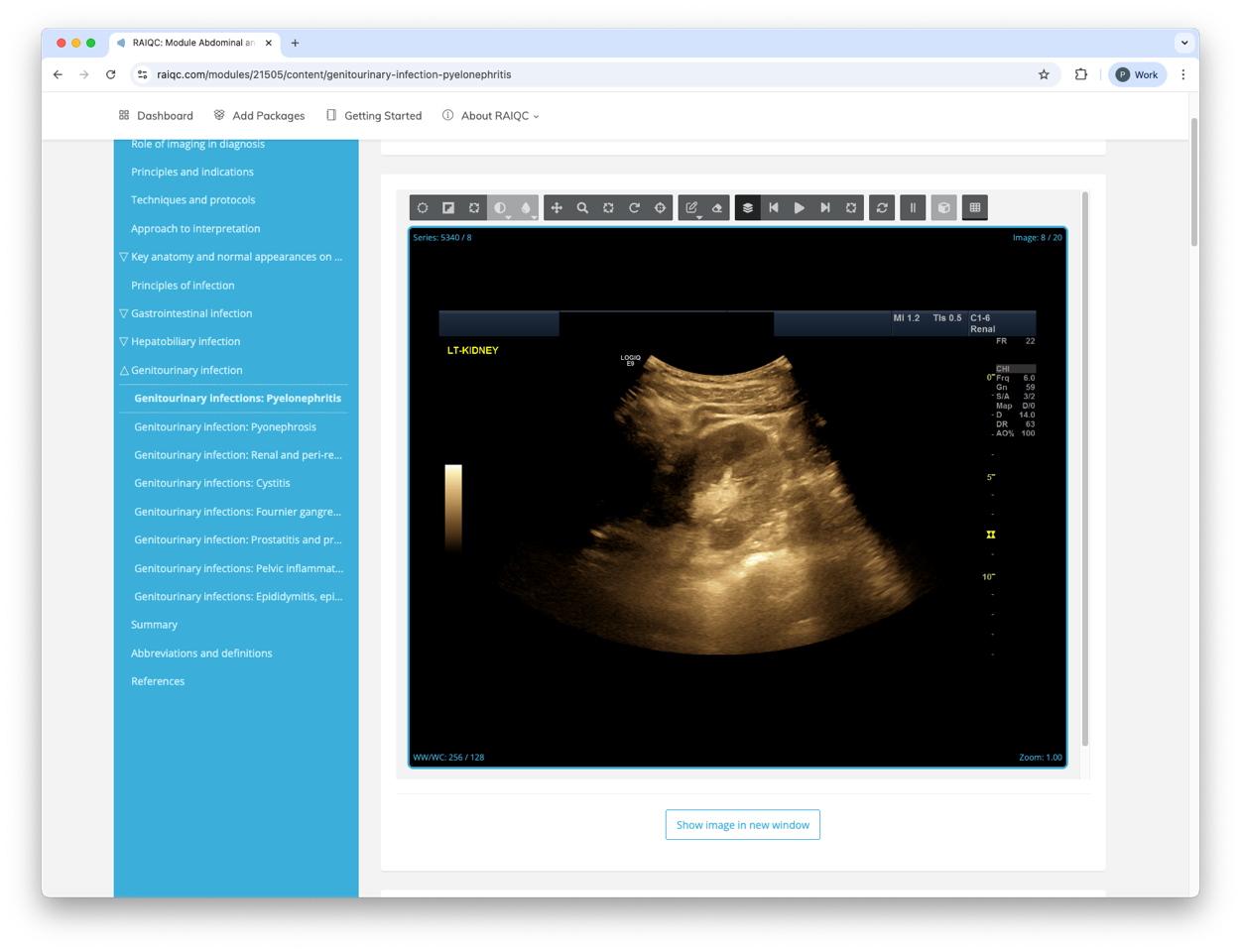Interactive case within teaching content