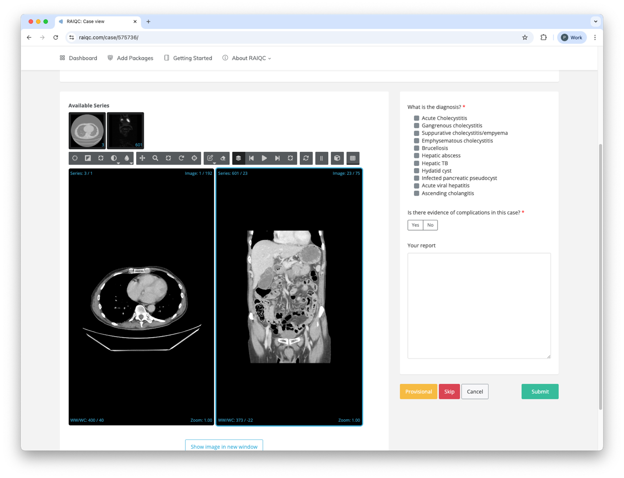 CT scan in an image viewer