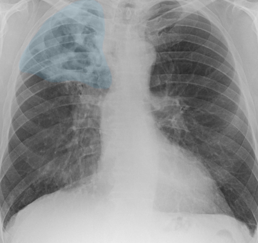 sample from PPT teaching material